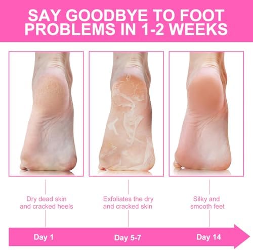 Foot Mask & Turmeric Oil, Deep Hydration Foot for Dry Cracked Skin, Nourishing Body Care with Vitamin E, SPA at Home - Image 5