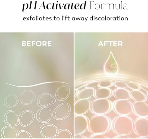 Olay Body Lotion for Women, Tone Enhancing with AHA Serum, Visibly Reduce Discolored Skin, 24hr Moisture & Hydration, Fast Absorbing Formula, Vit-B3 Complex, For All Skin Types, 17 Fl Oz (Pack of 6) - Image 6