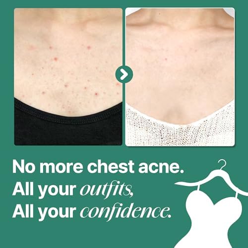 SOME BY MI AHA BHA PHA 30 Days Miracle Acne Clear Body Cleanser (Body Wash Big size 26.46 oz- Pack of 1) - Image 5
