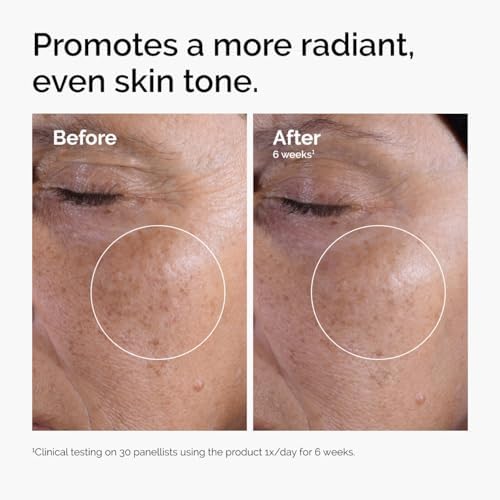 The Ordinary Glycolic Acid 7% Exfoliating Toner, Brightening and Smoothing Daily Toner for More Even-Looking Skin Tone - Image 2