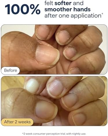 REMEDY Hand & Cuticle Firming Whipped Cream with Peptides - Image 3