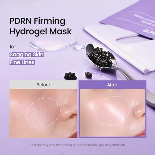 BIODANCE Rejuvenating Caviar PDRN Real Deep Mask, Overnight Hydrogel Face Mask, Skin Firming, Radiance, Enhancing Skin Recovery, Korean Skin Care, Self Care Gifts for Women | 1.19oz(34g) x 4ea - Image 3