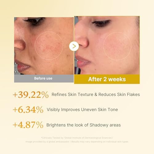 medicube Kojic Acid Turmeric Smoothing Toner for Face & Body | Lightweight Toner for Balancing Uneven Skin Tone & Texture | Niacinamide, Glycolic Acid for Clear Glass Skin | 8.45 fl.oz (Pack of 2) - Image 4