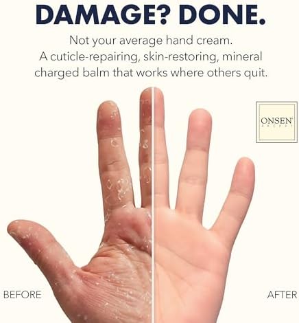 ONSEN Secret Advance Rescue Nail Kit - Strengthening Nail Oil & Serum with Hand & Cuticle Rescue Cream - Tsubaki, Shea Butter, Jojoba - Hydrates, Repairs, and Restores - Image 3