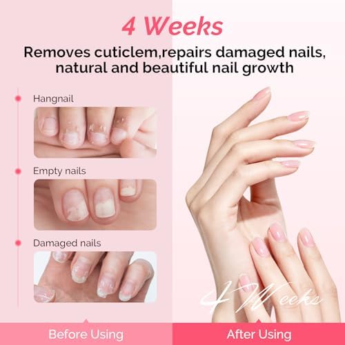 MelodySusie 10ML Cuticle Care Kit 2PCS - Image 2