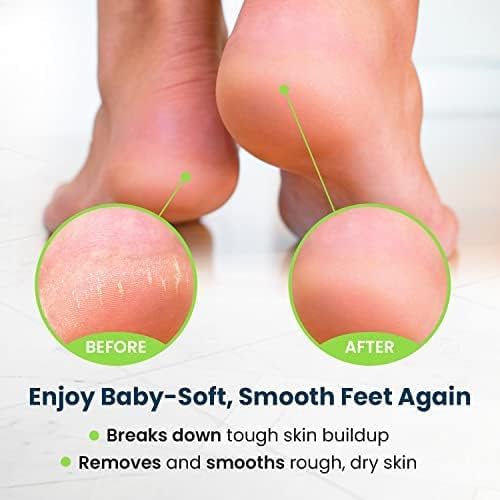 FOOT CURE Exfoliator & Callus Remover Pedicure Set – Care Kit Includes File for Dead Skin, Tea Tree Oil Soak Salts, Urea Cream 40 Percent Removal Gel Made in USA, 4 Piece