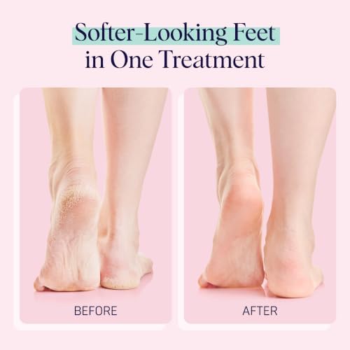 SpaLife Moisturizing Foot Sockies | Foot Mask for Dry Cracked Feet | Tea Tree Oil Softening Booties | Callus Remover Alternative | Self Care Gifts for Women | 4 Pack - Image 4