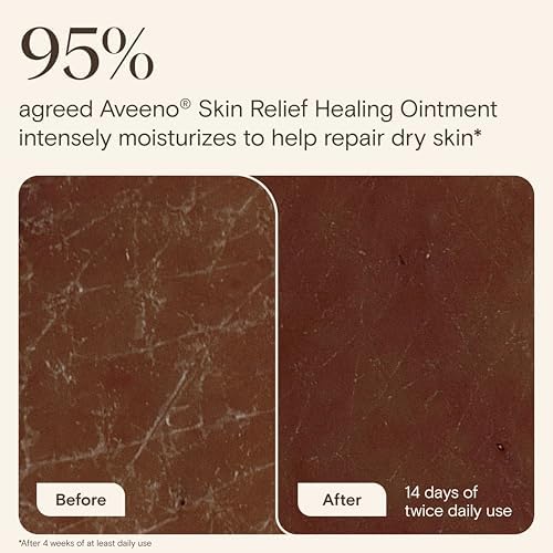 Aveeno Skin Relief Healing Ointment, Fragrance-Free, 2.0 oz - Image 3