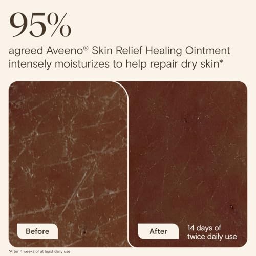 Aveeno Skin Relief Healing Ointment, Fragrance-Free, 14 oz Jar - Image 2