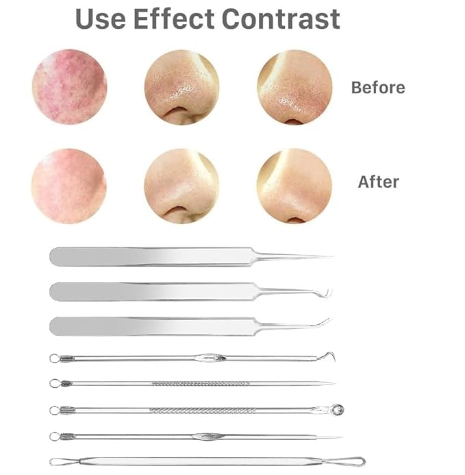 Pinkiou Blackhead Remover Comedone Pimple Popper Tool Acne Extractor Blemish Remover Ingrown Hair Tweezers Removal Kit Whitehead Remover Zit Treatment Skincare Tools for Face Nose,8 PCS