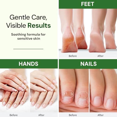 Natural Foot, Nail & Hand Cream - Skin Care & Nourishing Formula Rich Hydration with Tea Tree - Daily Repair Cream for Men & Women, Softens, Protects & Restores Skin 8oz - Image 4