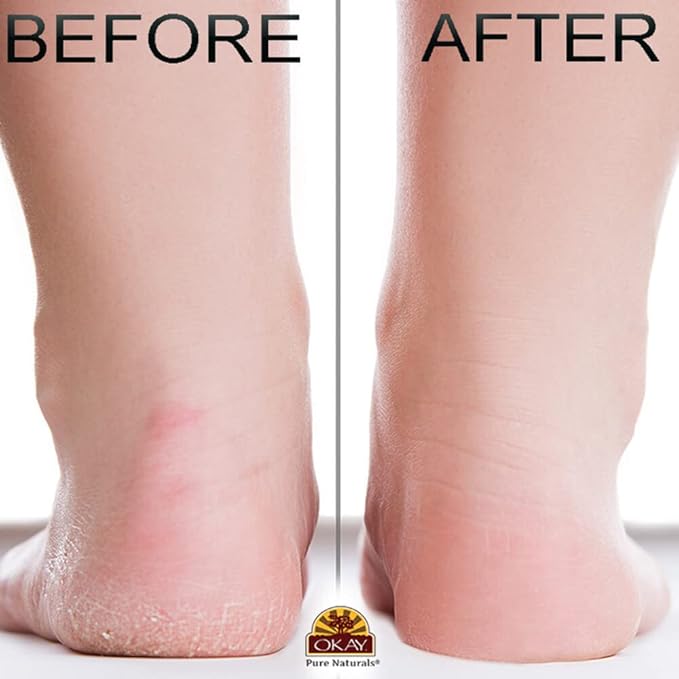 OKAY Peppermint Foot Scrub - Exfoliating Foot Scrub, Foot Exfoliator, Great for Cracked Heels, Pedicures, Dead Skin Remover, Exfoliant for Calluses, Moisturizer for Dry Skin - 6 Oz (Pack of 1)