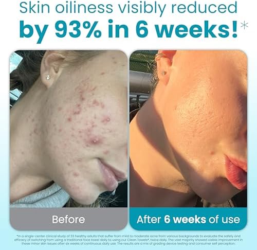 CLEAN SKIN CLUB Blemish Control Clean Towels® XL, Extra Exfoliation for Oily Skin, Disposable, Single-Use Face Towelette Dry Wipe - 1 Pack (50 Count) - Image 2