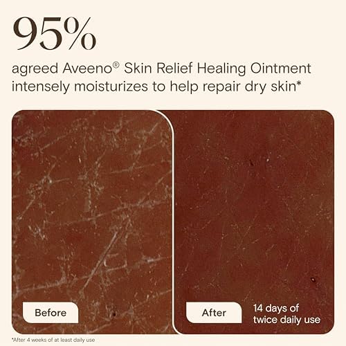 Aveeno Skin Relief Healing Ointment, for Extra Dry, Cracked & Sensitive Skin, 72-Hour Protectant with Triple Oat, Shea Butter & Glycerin, Fragrance-Free for Body, Face, Hands, Lips 7.2 oz - Image 4