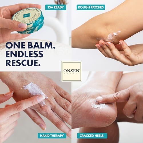 ONSEN Secret Essential Nail Reboot Kit with Hand & Cuticle Rescue Cream | Buffer Block, Professional File, Replacement Pads and Repair Cream for Strong, Healthy, Shiny Natural Nails at Home - Image 2