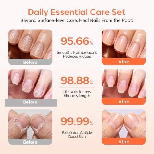 Modelones Cuticle Remover Kit, Cuticle Trimmer Nail Stuff & File Nail Kit - Image 2