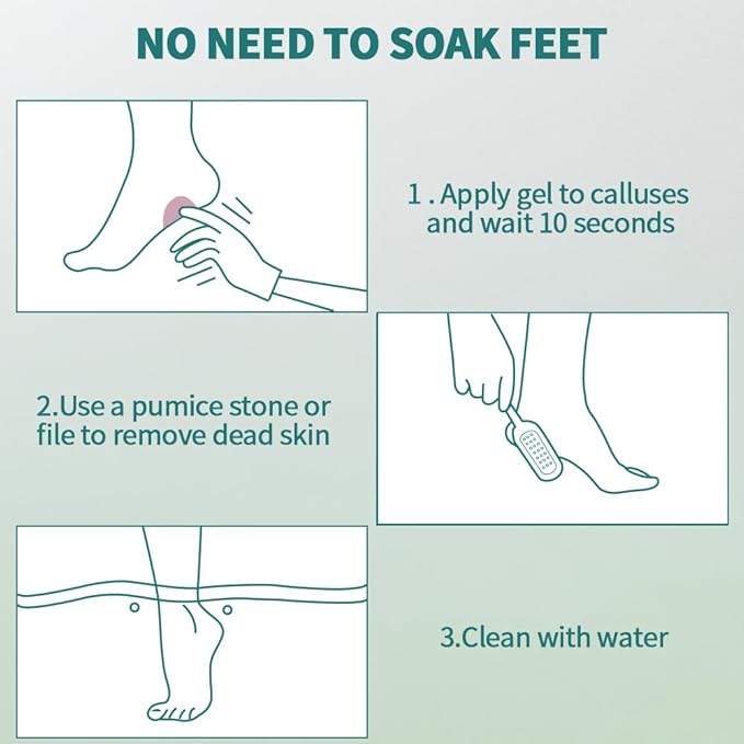 Gorgellux Callus Remover Gel, Callus Remover for Feet, Foot Callus Remover Gel Set for Dead Skin, Salon Pedicure Spa Kit, Callus Remover for Feet Gel, Quickly and Effortless Remove, 2PCS