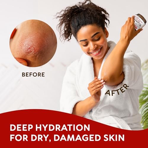 RICHGRAND Beef Tallow for Skin 2 Pack - Whipped Tallow and Honey Balm - Grass Fed Beef Tallow for Face, Daily Moisturizer & Body Butter - Natural Non Comedogenic Skincare (8.6 oz) - Image 6