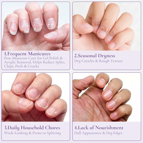 Cuticle Cream for Nails, Moisturizer for Dry Cracked Cuticles, 15ml - Image 3