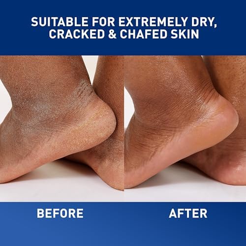 CeraVe Healing Ointment, Hyaluronic Acid Skin Protectant for Dry Skin, 12oz - Image 5