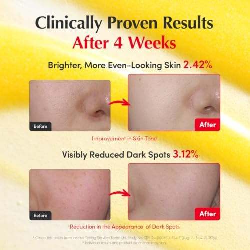 EQQUALBERRY Vitamin Illuminating Serum Double Pack | Niacinamide 4% & TXA | Brightening Vitamin C Serum for Glow & Hyaluronic Acid | Dark Spot & Uneven Tone Care | Korean Skincare, 1.01 oz (Pack of 2) - Image 3