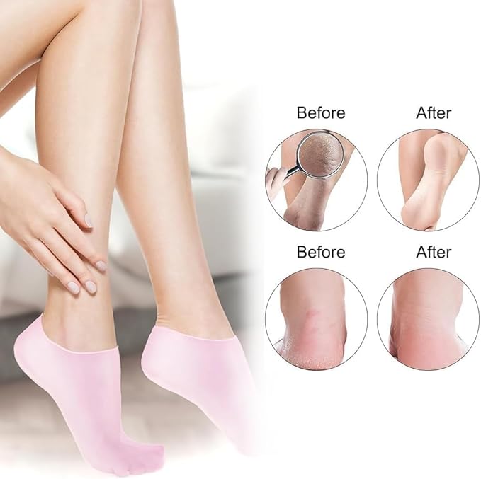 2 Pairs Silicone Moisturizing Glove Socks Set for Dry Cracked Feet and Hands, Anti Slip Spa Socks Women Gel Pedicure Socks for Foot Hand Softening Foot Care After Pedicure (Skin Color)
