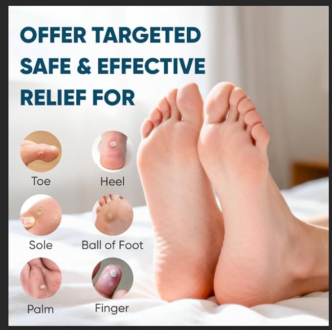 96P Corn Remover Pads for Feet and Toes, Extra Strength 40% Salicylic Acid Medicated Patches, Effective Treatment for Small Callus and Dead Skin