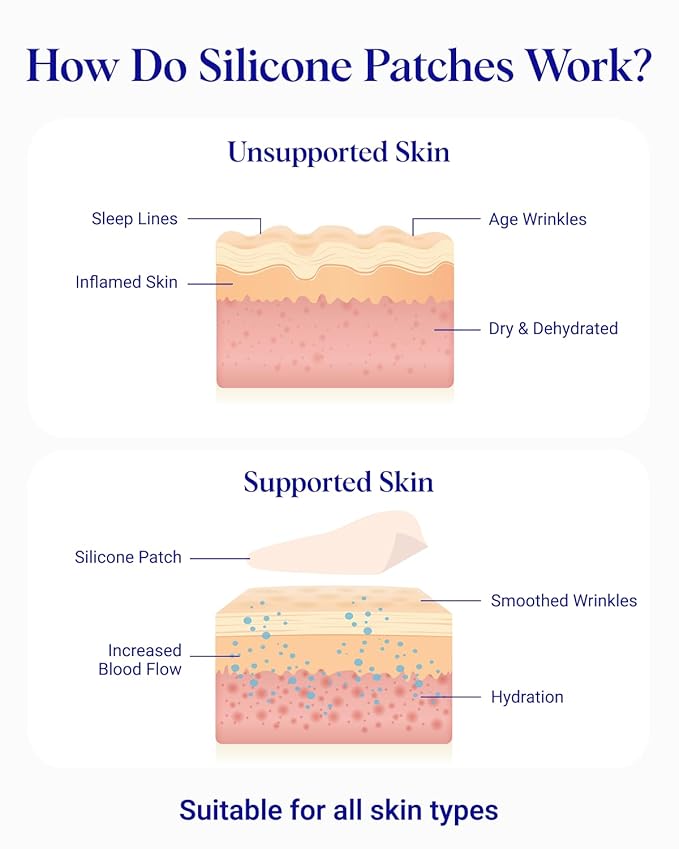 Wrinkles Schminkles Under Eye Wrinkle Patches | Smooth Eye Wrinkles, Crows Feet & Dark Circles Overnight | 6 Pairs Reusable Medical Grade Anti Wrinkle Sleep Silicone Patches