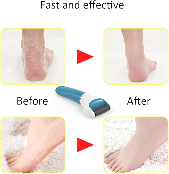 Electric Foot File Callus Remover Professional, 2-Speed Rechargeable Pedicure Tool for Remove Calluses, Dry, Hard, Dead, Cracked Skin, Includes 2 Coarses (Blue)