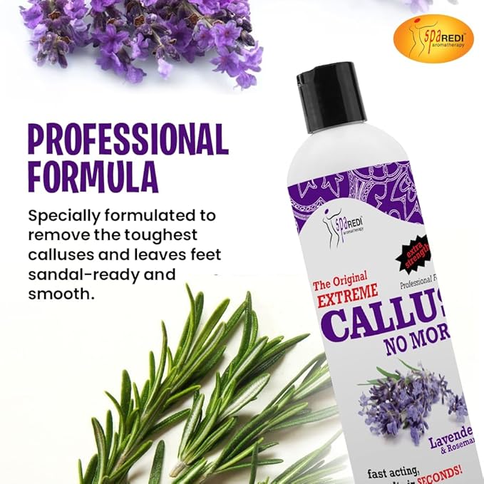 SPA REDI Callus Remover - Professional-Grade Callus Dissolving Treatment - Stop Scraping. Start Dissolving. Chemically Dissolve Toughest Buildup for a Dramatic 'Wow' Transformation 12 Oz