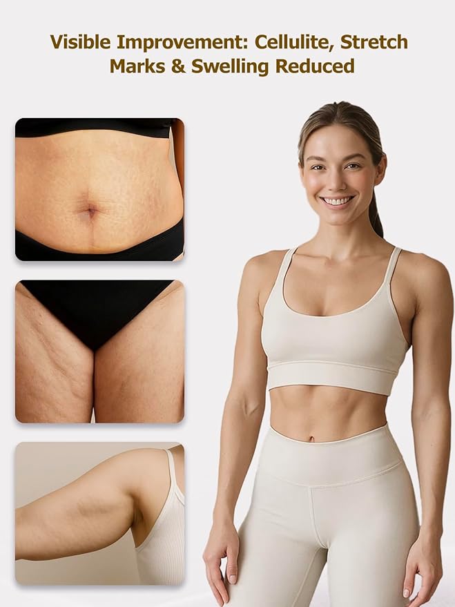 Yuonry Lymphatic Drainage Massager & Anti Cellulite Massage Tool, Helps Reduce Stretch Marks & Cellulite, for Legs, Arms & Belly, Body Sculpting Machine with Microcurrent, Light, Heat & Vibration