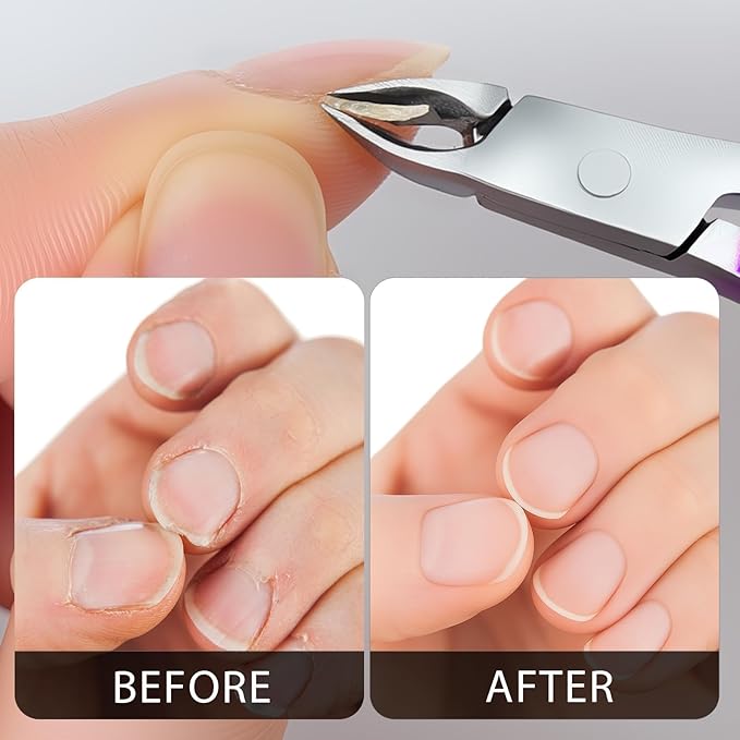 Cuticle Nippers Kit: Precision Nano-Coated Stainless Steel Cuticle Trimmer Remover for Fingernails and Toenails, Cutter for Manicure Pedicure, Nail Clippers Tools for Women (Red- 1 PACK)