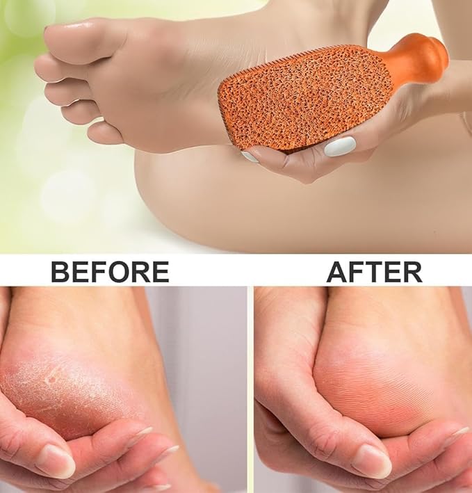 QUBA LINEN Pumice Stone for Feet - 2-Sided Terra Cotta Foot Scrubber, Professional Exfoliating Clay Stone for Feet Hands Body Care - Pumice Stone for Feet Callus Remover, Brown (Pack of 2)