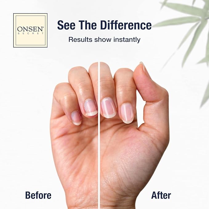 Onsen Secret Nail Care Kit - Includes Cuticle Oil 10ml, Japanese Nail Buffer and Shine Kit - Spa-Quality Manicure - Organic Ingredients - Long-Lasting Shine - Easy & Safe - 1pk