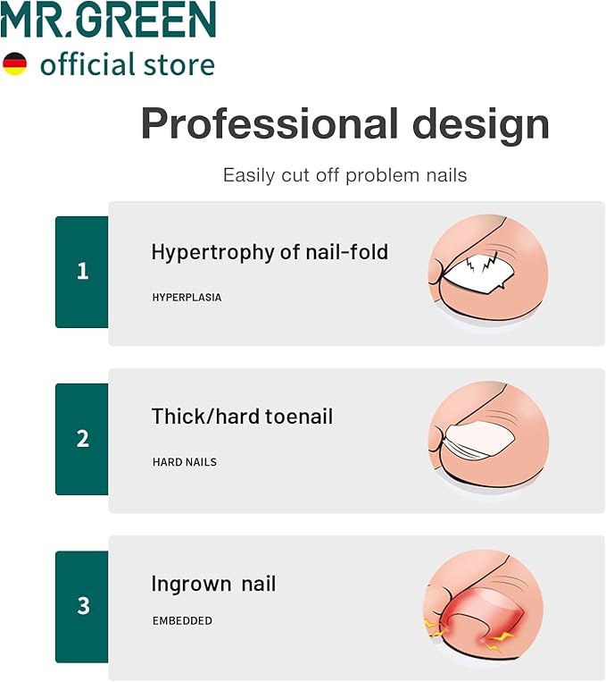 MR.GREEN Toenail Clippers Stainless Steel Ingrown Nail Cutter Thick and Hard Nails Pedicure Manicure Tools (Orange)
