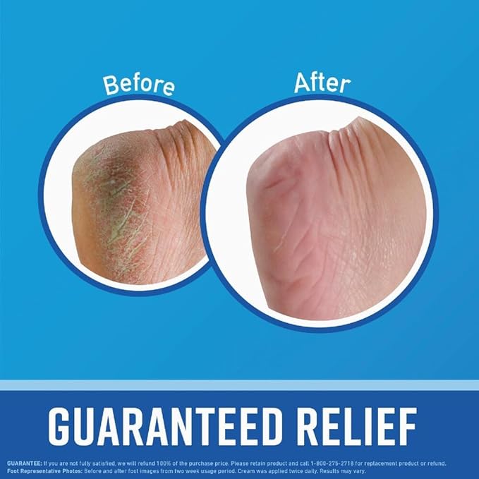O'Keeffe's Healthy FEET Foot Cream