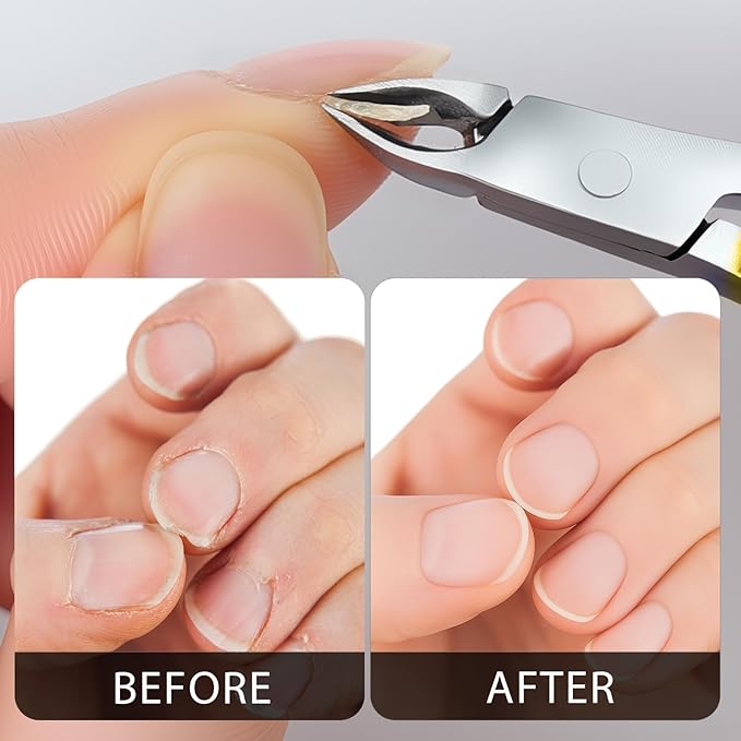 Cuticle Nippers Kit: Precision Nano-Coated Stainless Steel Cuticle Trimmer Remover for Fingernails and Toenails, Cutter for Manicure Pedicure, Nail Clippers Tools for Women (Gold+ Red 2PCS)