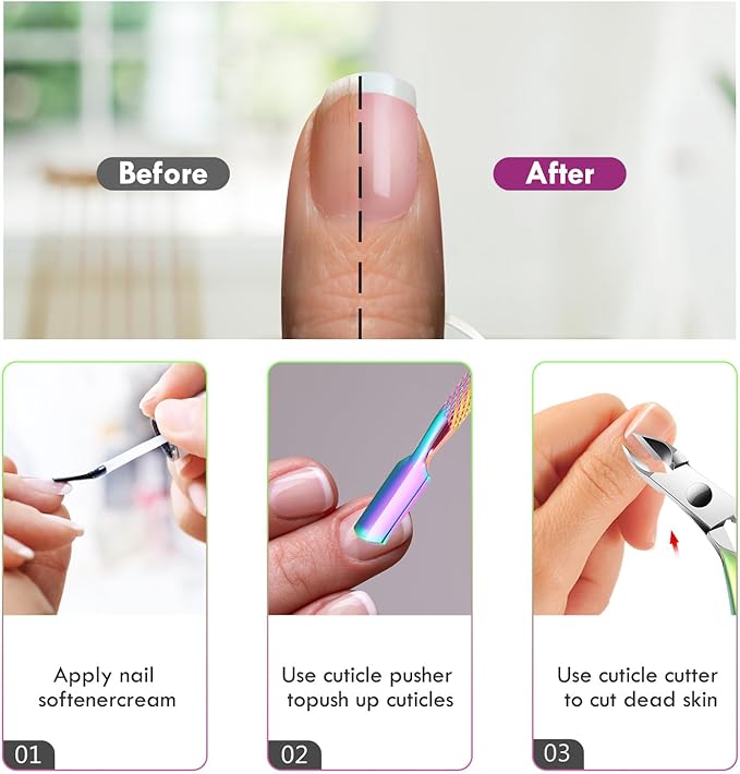 Cuticle Trimmer Cuticle Remover with Cuticle Pusher, XUNXMAS Professional Stainless Steel Durable Pedicure Manicure Tools Cutter Nipper Scissor Clipper for Fingernails and Toenails Dead Skin