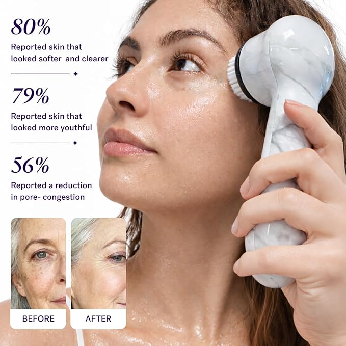 Michael Todd Beauty Soniclear Allure 2024 Best of Beauty Winner Facial Cleansing + Exfoliation Brush System with Antimicrobial Protected Bristles, 4 speeds, Serum Infusion Head + Travel Case