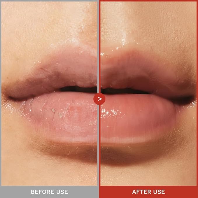 haruharu wonder Rose PDRN Peptide Glowy Balm, Instant Moisture, Repairs Dry Cracked Lips, 24HR Moisture, No Waxy Finish, Vegan, Silicon Free, Micro Plastic Free, Tint-free, 0.33 fl.oz