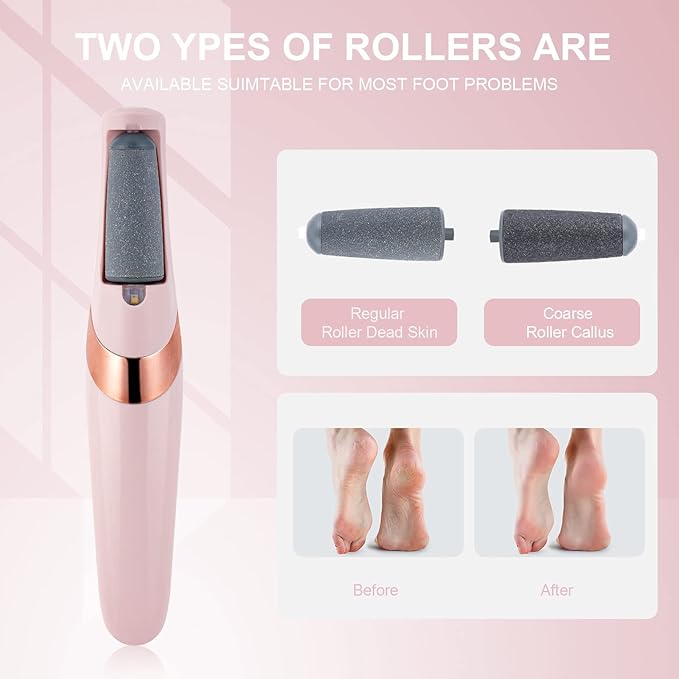 AOOWU Electric Foot File, USB Rechargeable Feet Callus Remover with 2 Speed of Replacement Rollers & LED Lights, Professional Hard Skin Remover Foot Care Tools for Cracked Heels Calluses & Dead Skin