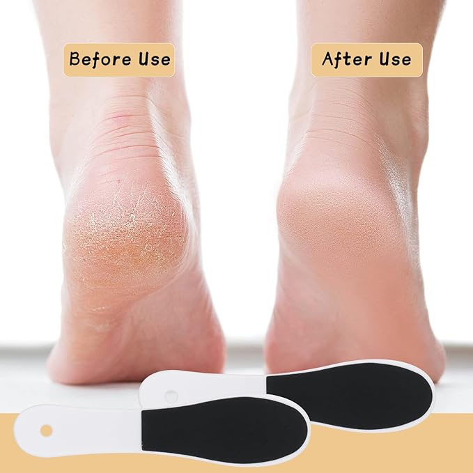 20 Pcs Foot File Callus Remover Double Side Skin Foot File Professional Foot File Pedicure Tools for Dead Skin Smoothing