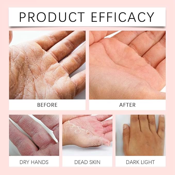 Retinol Hand Cream Anti Aging, Enriched With Collagen, It is Specially Formulated for Aging, Dry, And Chapped Hands (50G Anti Aging Hand Cream, Nourishing and Protecting Skin, Nails, And Cuticles)