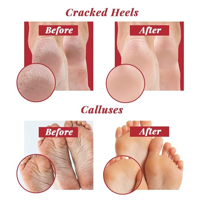 Checi Autoclave Sanitize and Sterilize Dual Coarse and Medium Foot File Carded