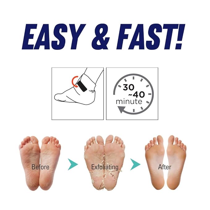 Epielle Foot Peel Mask | 2 Pairs | For Cracked Heels, Dead Skin & Calluses | Smooth & Repair Rough, Dry Skin | Beauty Gift, Spa Day, Gift Set | Korean Skincare