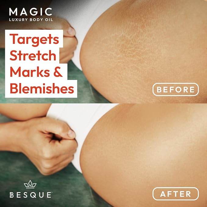 Besque Magic Body Oil, 3.4 FL OZ, After Shower Body Oil For Women, Hydrating Skin Care For Full Body That Plumps, Tightens, and Firms Skin With Natural Ingredients, Luxury Spa Gifts - Pack of 1