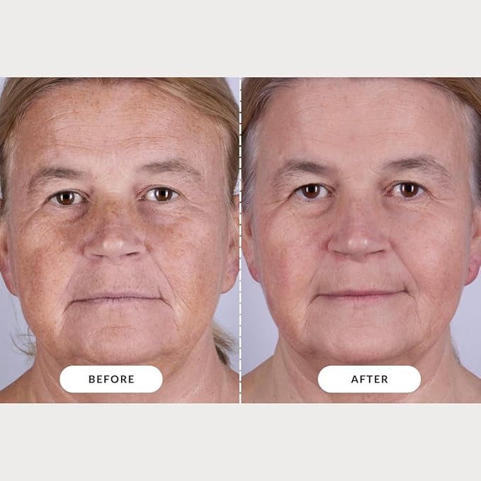 CurrentBody Skin LED Light Therapy Mask: Series 2