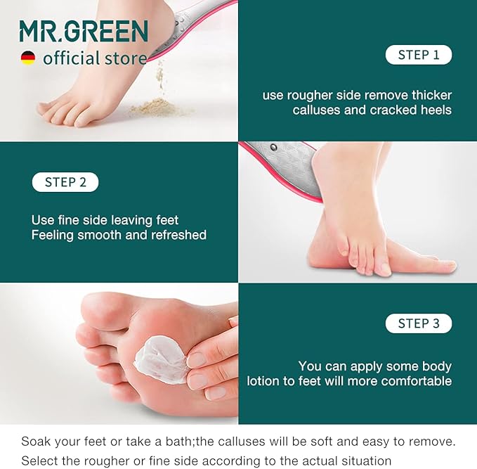 MR.GREEN Foot File Double Sided Pedicure Foot Care Tools Professional Callus Remover Foot Rasp Stainless Steel Foot Scrubber for Feet (Red)