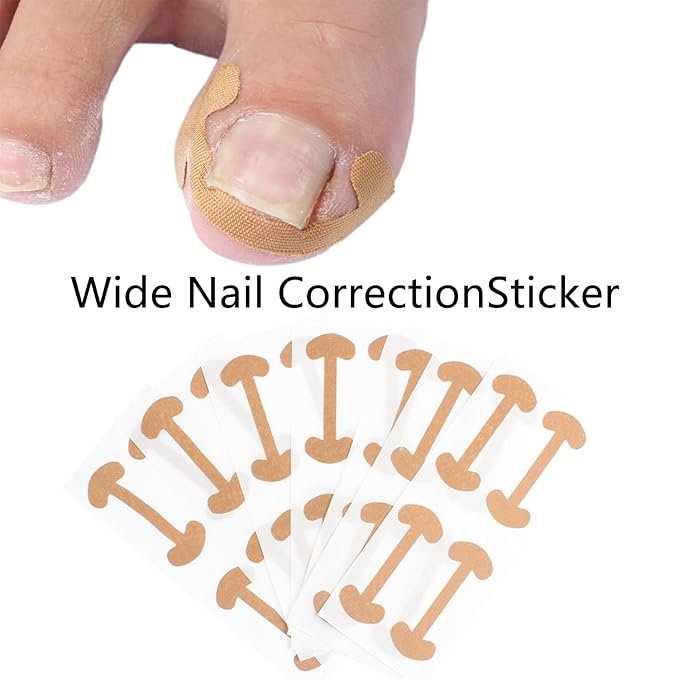 Ingrown Toenail Corrector Set with Correction Strips,Professional Ingrown Toenail Tool kit,Curved Toenails Corrector Patch,For Home Pedicure Care
