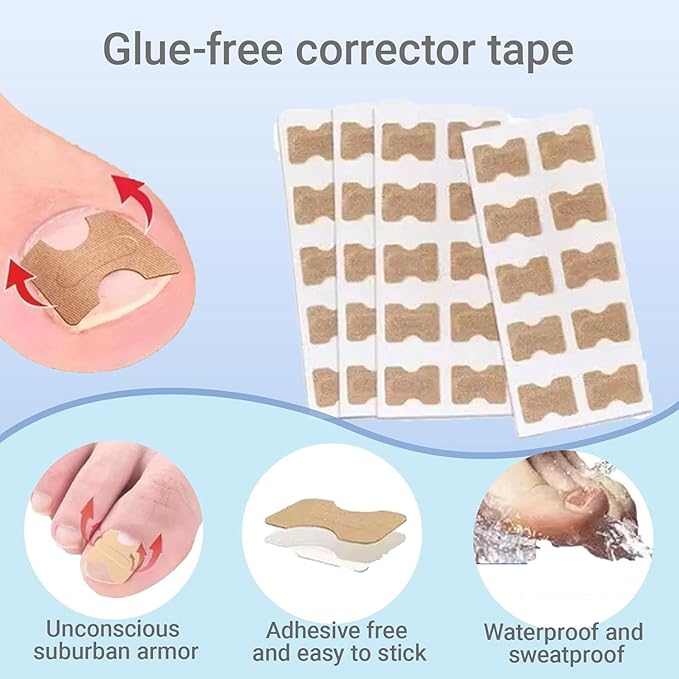 Ingrown Toenail Corrector Set with Treatment Tools & Correction Strips, Professional Pedicure Tools for Feet – Painless Ingrown Toenail Treatment and Home Care Solution for Men and Women (1Set)